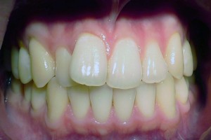 acecareortho1a   