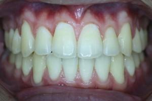 acecareortho1b   