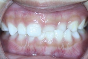 acecareortho3a   