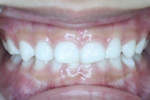 acecareortho3b   