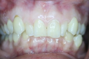 acecareortho4a   