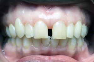 acecareortho4b   